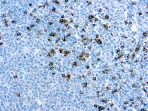 CD8, T Cell SP16